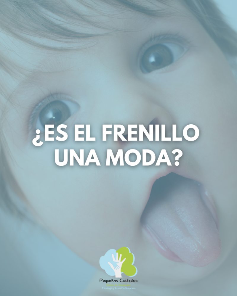 ¿Es el frenillo una moda?
